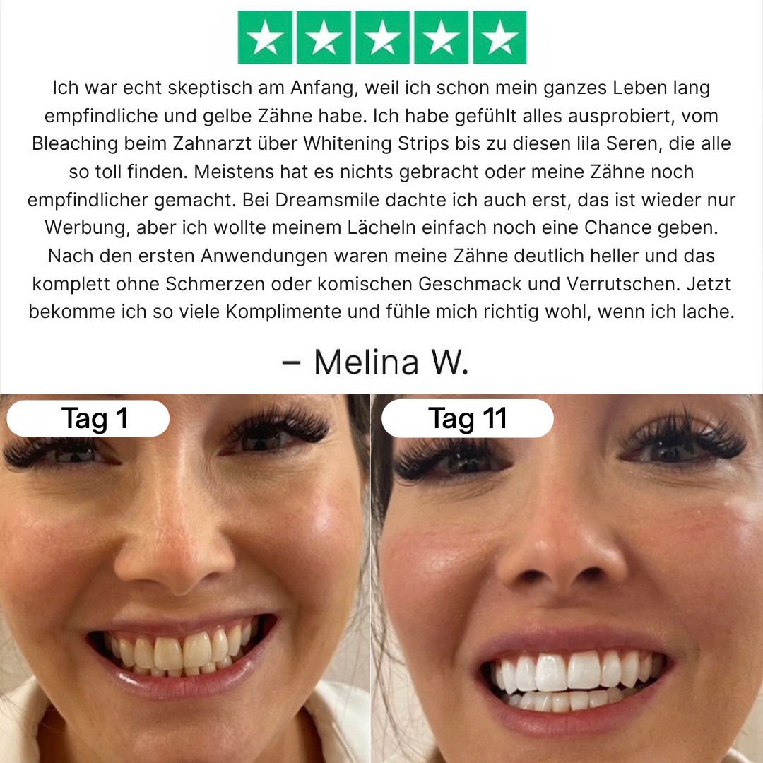 DREAMSMILE™ P34 WHITENING STRIPS