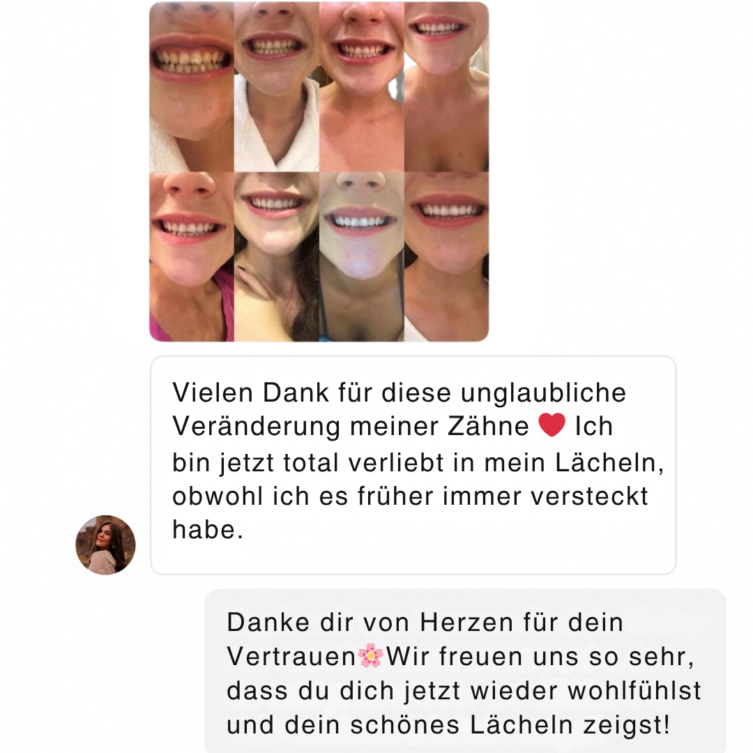 DREAMSMILE™ P34 WHITENING STRIPS