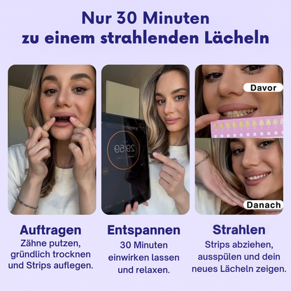 DREAMSMILE™ P34 WHITENING STRIPS